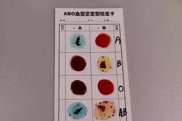 A血型性格