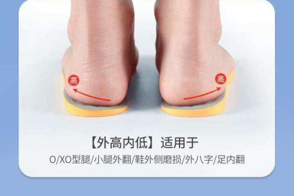 内八字和外八字