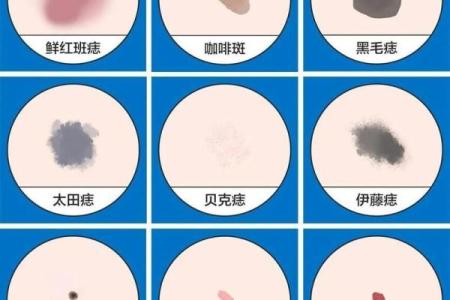 知命运，脸上胎记算命什么说法