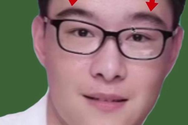 眉心八字纹的男人面相