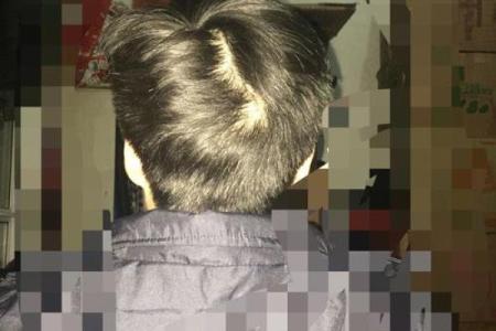 后脑勺有三条竖杠 后脑勺头皮三条竖纹算命