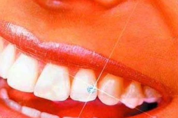牙齿算命 有鬼牙不吉利吗