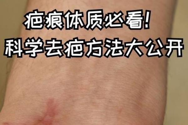 八字看身体伤疤部位的秘诀方法