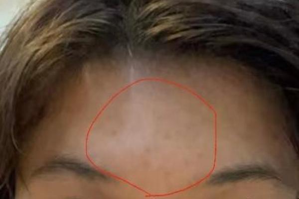 风水上印堂发黑是不是跟了鬼
