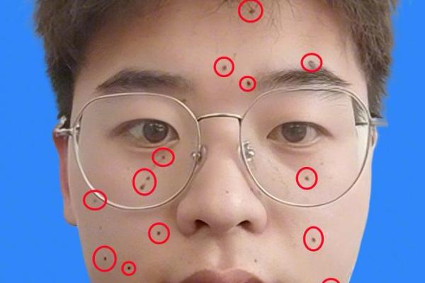 男人脸部有痣,算命你运势好坏 男人脸部有痣,算命你运势好坏