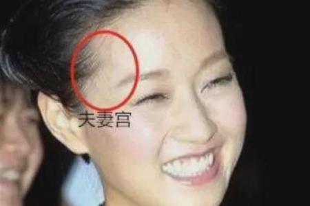 脸上胎记算命看出命运