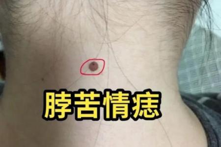 女人背部痣相图解算命