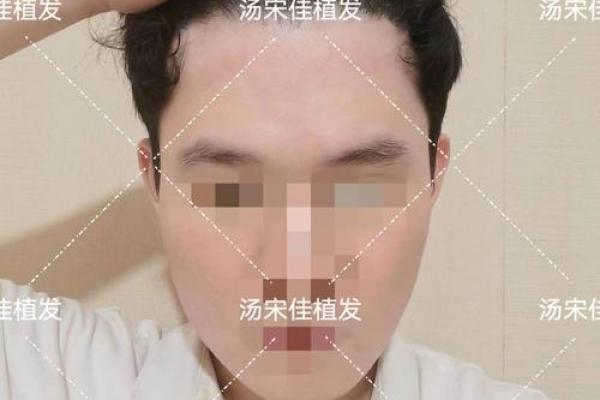 头发稀少的八字特征 八字头发稀少