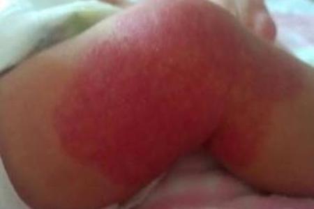 红色胎记算命图解